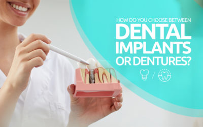 How do you choose between dental implants or dentures?