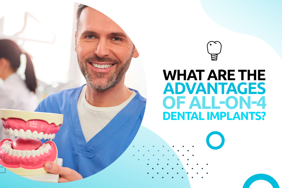 What are the Advantages of All-on-4 Dental Implants?
