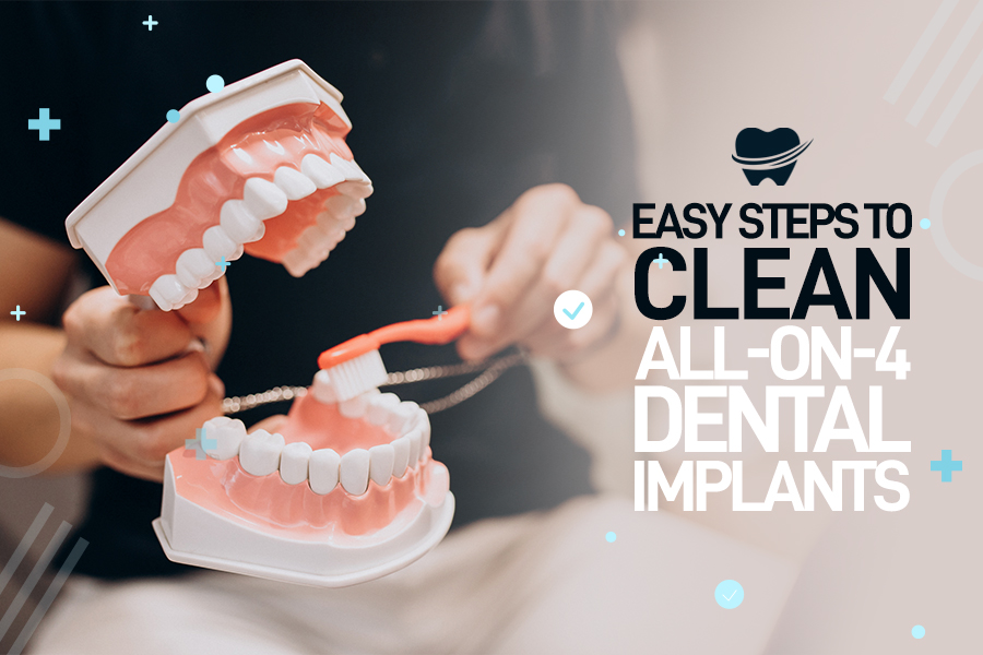 how to clean all on 4 dental implants