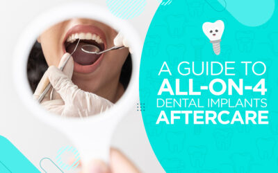 A Guide to All-On-4 Dental Implants Aftercare