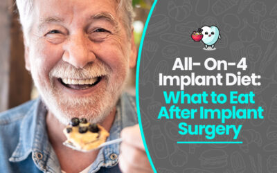 All- On-4 Implant Diet: What to Eat After Implant Surgery