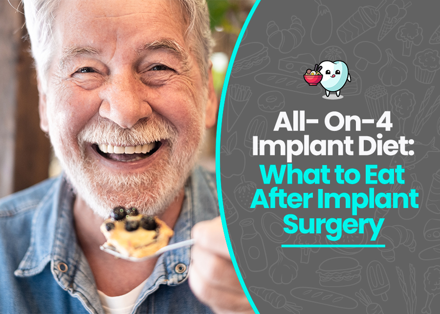 All- On-4 Implant Diet: What to Eat After Implant Surgery