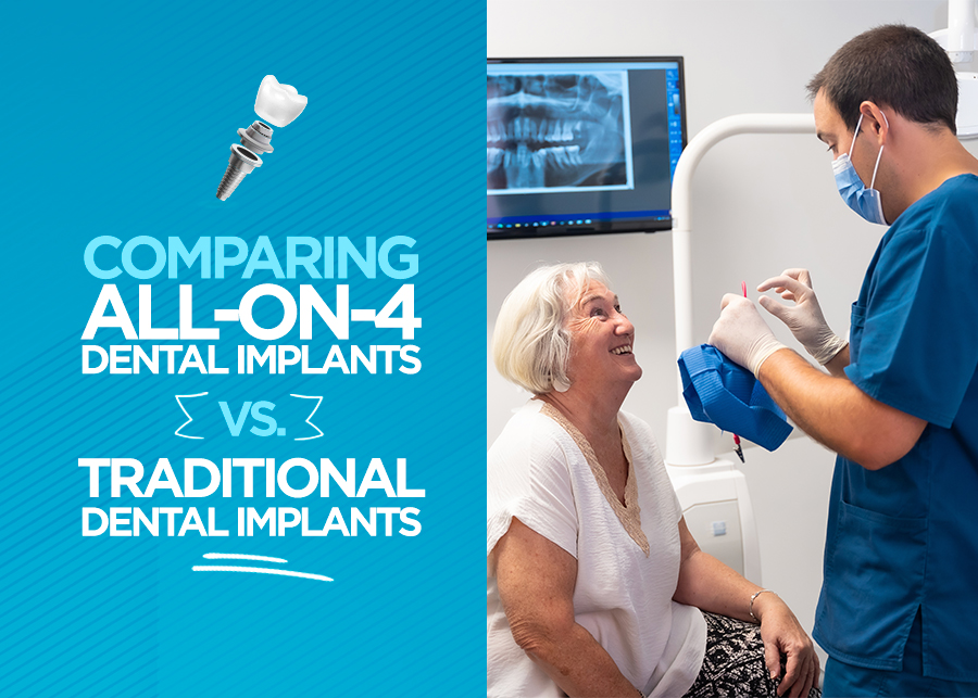 Comparing All-On-4 Dental Implants vs. Traditional Dental Implants