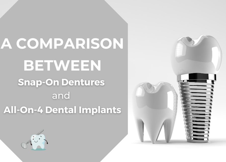 A Comparison Between Snap-On Dentures and All-On-4 Dental Implants