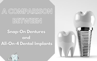 A Comparison Between Snap-On Dentures and All-On-4 Dental Implants
