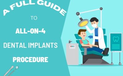 A Full Guide to All-On-4 Dental Implants Procedure