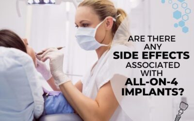 Are There Any Side Effects Associated with All-On-4 Implants?