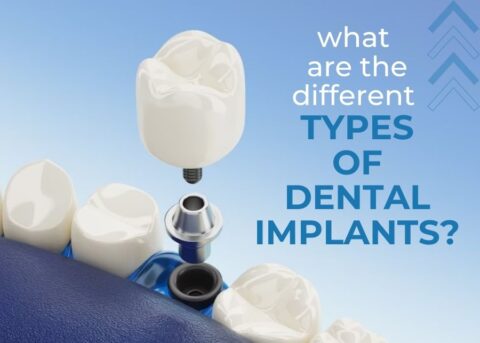 What are the Different Types of Dental Implants? - Parker Dental ...