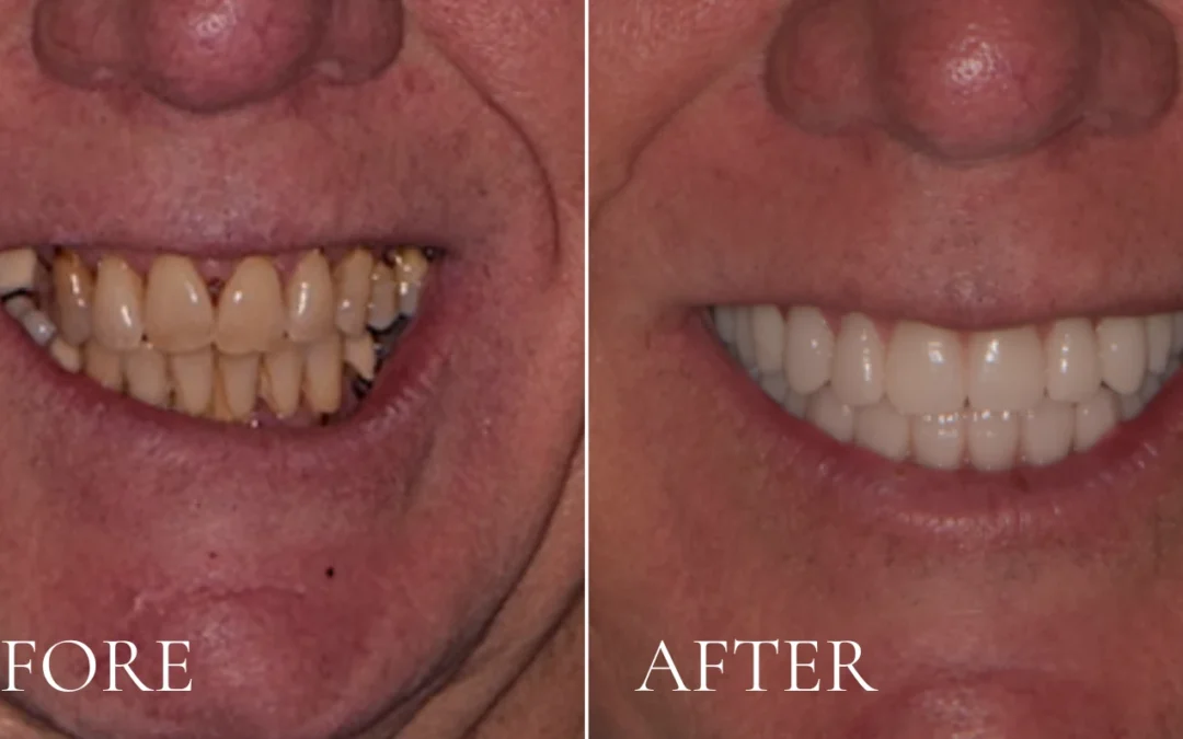 How Modern Restorations Bring Back Comfort And Confidence