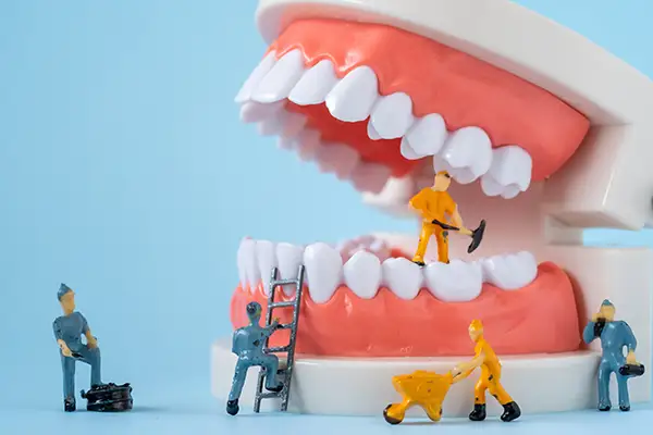 Denture repair process restoring a damaged removable prosthesis