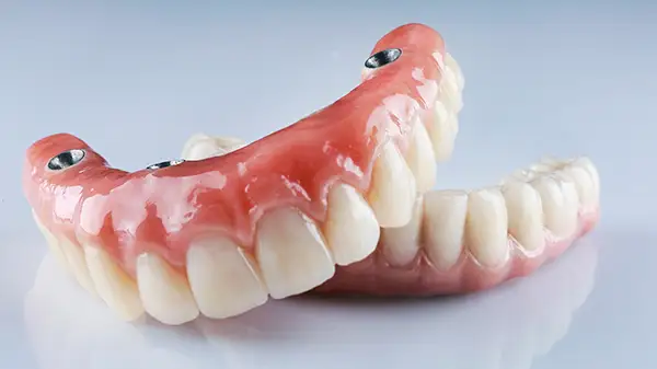 Implant-supported denture secured by dental implants for stable tooth replacement