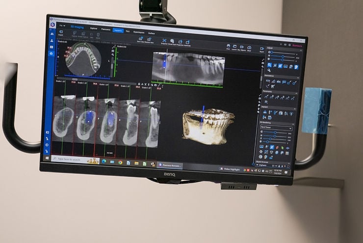 X-ray of jaw in different angles