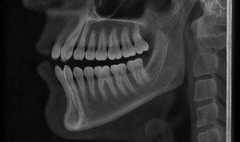 dental-cbct-scan