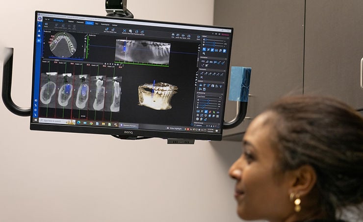 Restoring More Than Smiles: The Vital Role of Maxillofacial Prosthetics