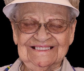 Maxillofacial-prosthetics