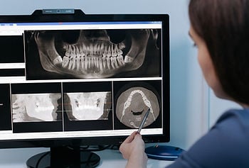 Person analyzing dental X-rays on a monitor with a pen. Images show different angles of jaw. Blue shirt, office setting, focused mood.