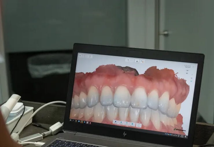 teeth-scan
